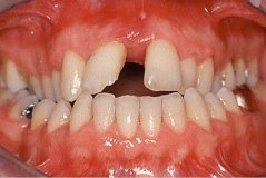 Ortodonzia