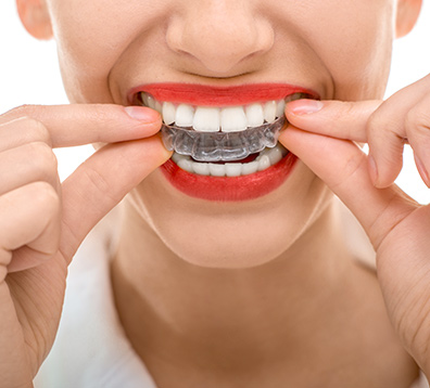 Studio Dentistico Dott. Angelo Cisternino